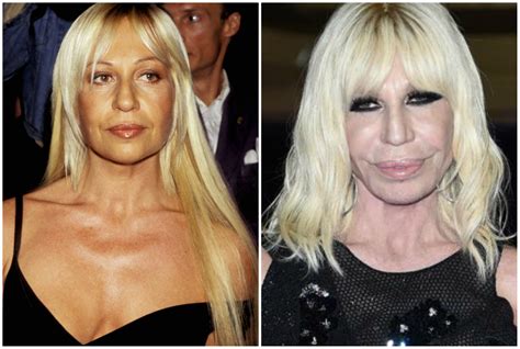 donatella versace prima dopo|Donatella Versace pictures when young.